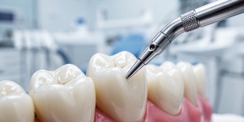 Canal Dentário: Quando é Indicado?