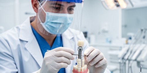 Dentista para Prótese Sobre Implante em Itapevi