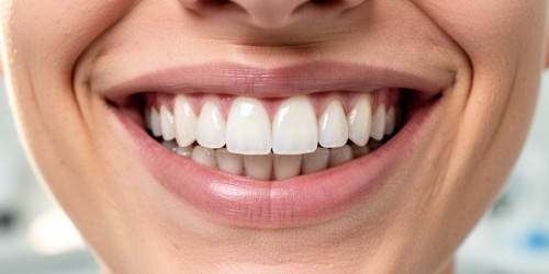 Como Corrigir Dentes Pequenos com Odontologia Estética
