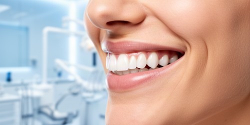 Quanto Tempo Dura o Clareamento Dental?