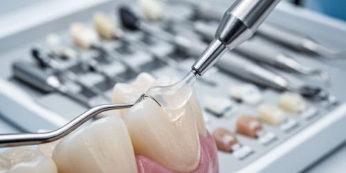 Como aumentar a previsibilidade clínica com bons materiais